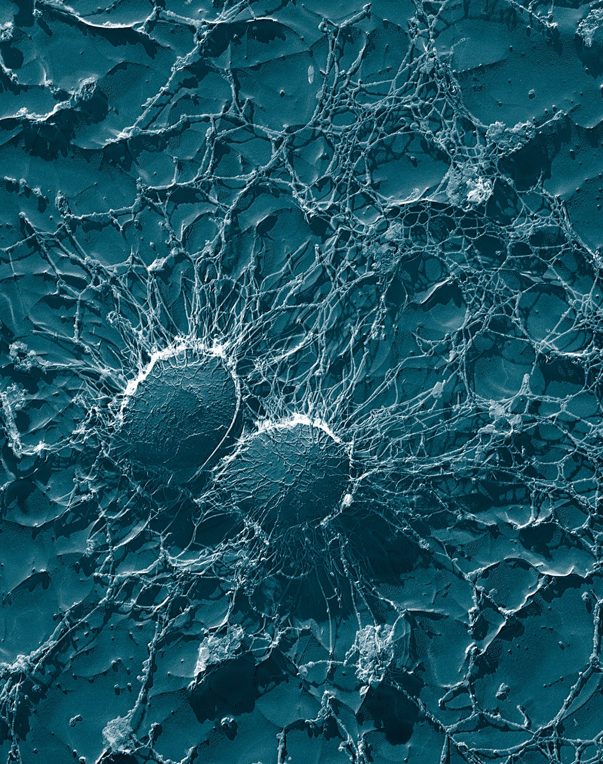 Staphylococcus aureus (50,000x)
