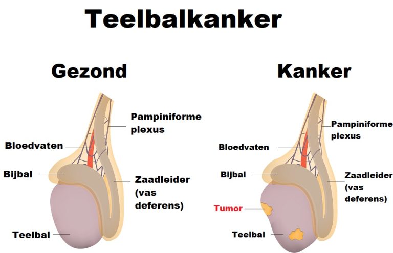 Liespijn Oorzaken Van Pijn In De Lies Mens Gezondheid