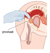 Prostaatonderzoek