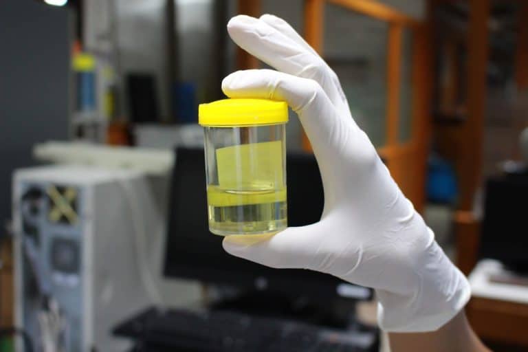 Stinkende urine oorzaken vies ruikende plas Mens & Gezondheid Stinkende urine oorzaken vies ruikende plas Mens & Gezondheid