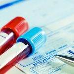 Bloedgassen: normaalwaarden en uitleg bloedgasonderzoek