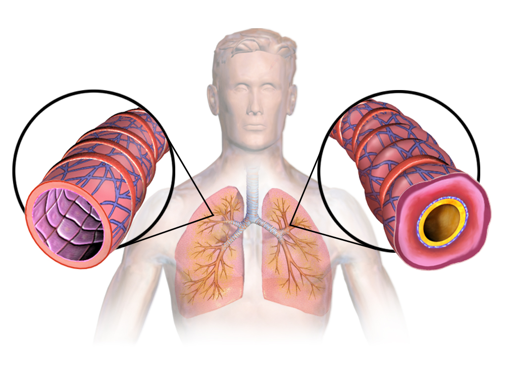 Astma (longen)