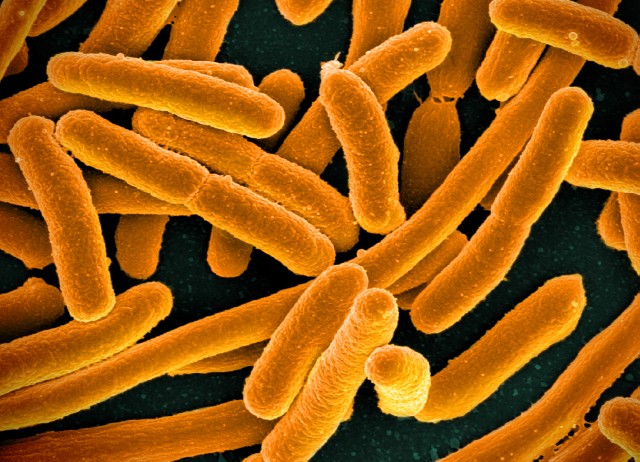 E. coli Bacterie