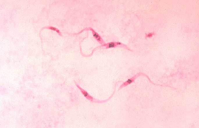 Giemsa-kleuring Trypanosoma cruzi