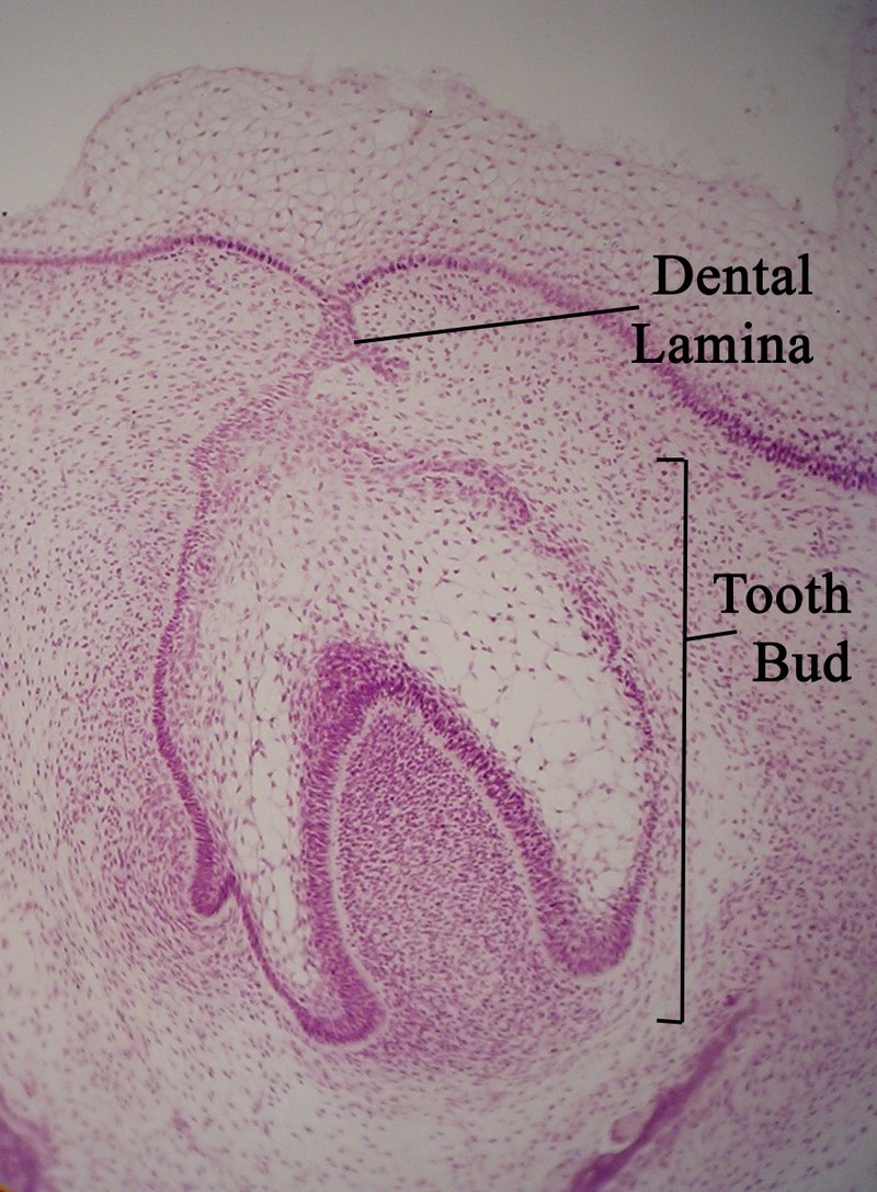 Lamina dentalis