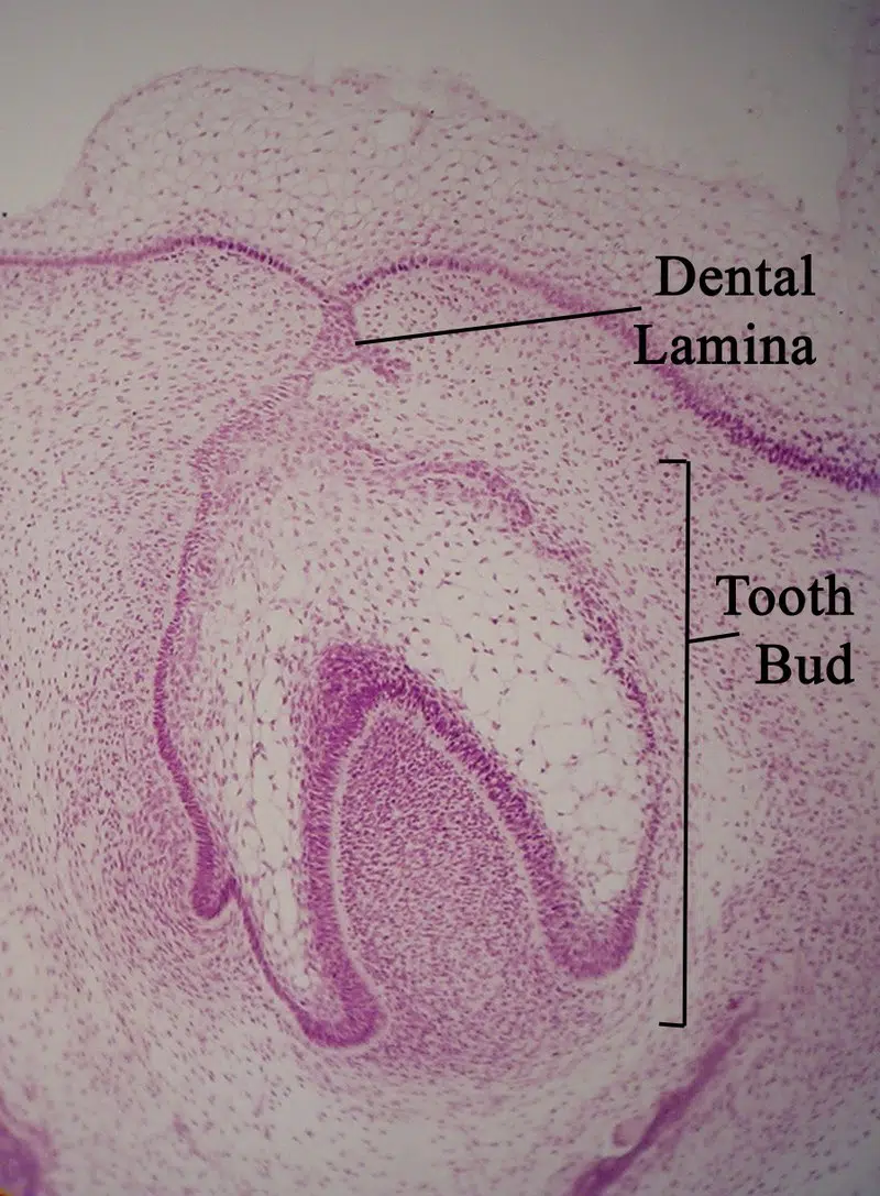 Lamina dentalis