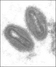 Monkeypox (virus)