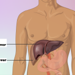 Vergrote lever: symptomen en behandeling