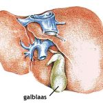 Galblaasruptuur: symptomen en oorzaak gescheurde galblaas