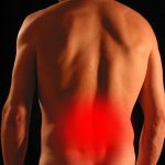 Gekneusde rug: symptomen, oorzaak en herstel