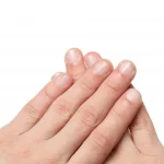 Stinkende nagels: oorzaken en behandeling