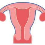 Baarmoederontsteking: symptomen, oorzaken en behandeling