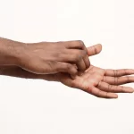 Jeukende handpalmen: oorzaken en symptomen