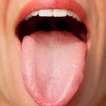 Tintelende tong: oorzaken van prikkelende tong