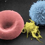 Trombocyten te hoog: te veel bloedplaatjes (trombocytose)