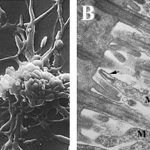 A) Langgerekte cellen van Mycoplasma pneumoniae