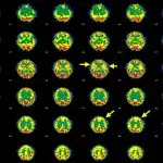 Hersens-SPECT-transaxiale beelden van een patiënt die lijdt aan Hashimoto-encefalopathie