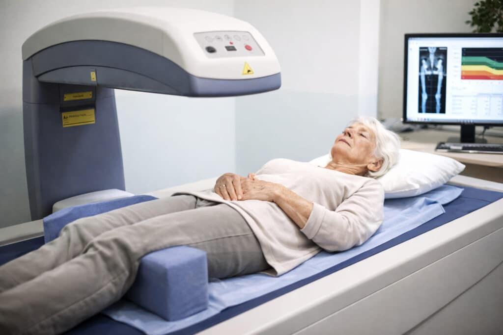 Oudere vrouw ondergaat een DEXA-scan waarbij de botdichtheid van heup en wervelkolom wordt gemeten
