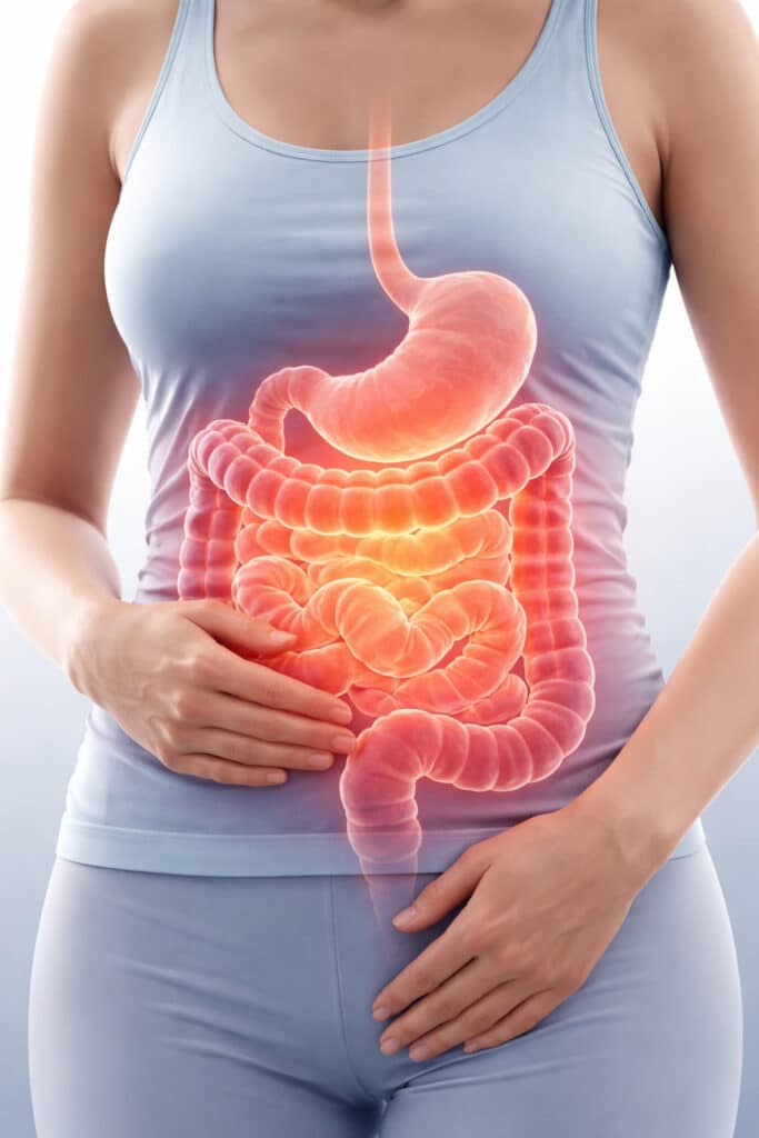 Medische illustratie van een vrouwentorso met zichtbare maag en darmen bij buikklachten