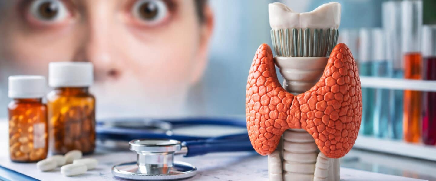 Model van een vergrote schildklier op een bureau met medische instrumenten, met op de achtergrond een vrouw met oogklachten passend bij de ziekte van Graves.