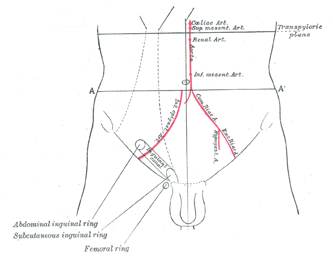 Anatomische lijntekening van de onderbuik van een man met weergave van het lieskanaal en omliggende structuren, inclusief de abdominale en femorale ring.