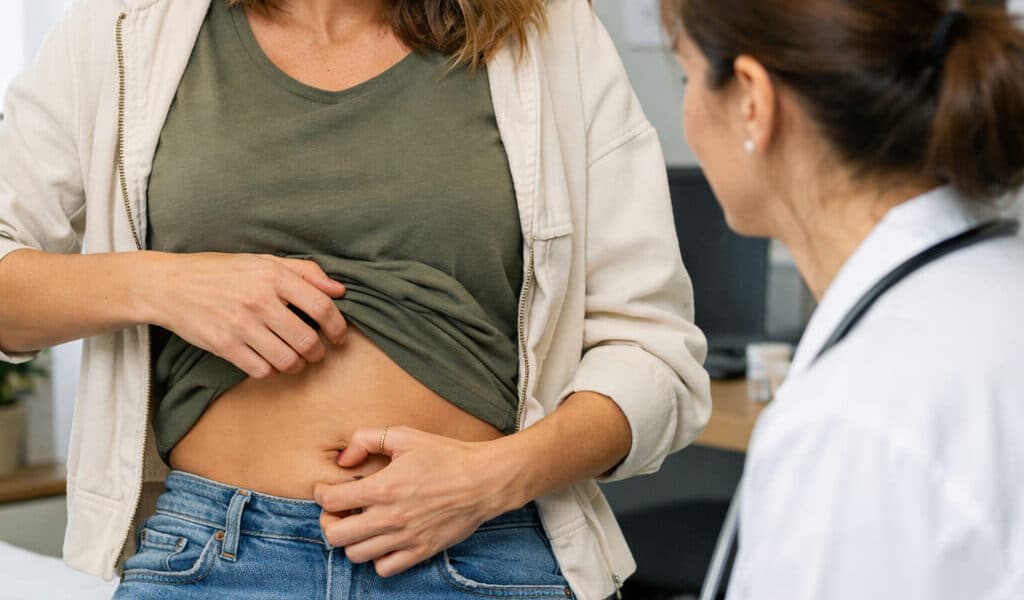 Vrouw met jeuk aan de navel bespreekt haar klachten met de huisarts tijdens een consult