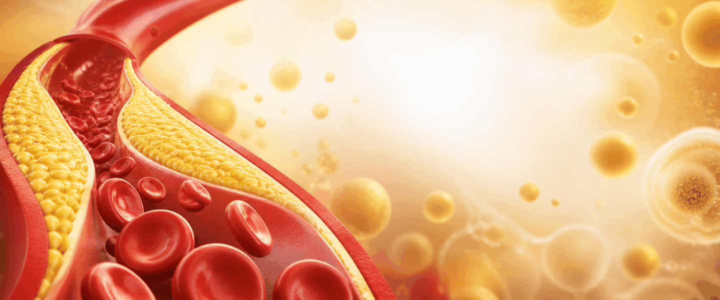 3D-medische illustratie van een bloedvat met cholesterolophoping en rode bloedcellen, weergegeven als brede header met warme lichteffecten.