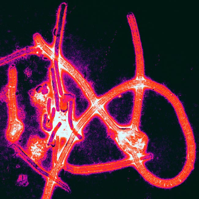 Kleurversterkte elektronenmicroscopische opname van draadvormige ebolavirusdeeltjes tegen een donkere achtergrond.