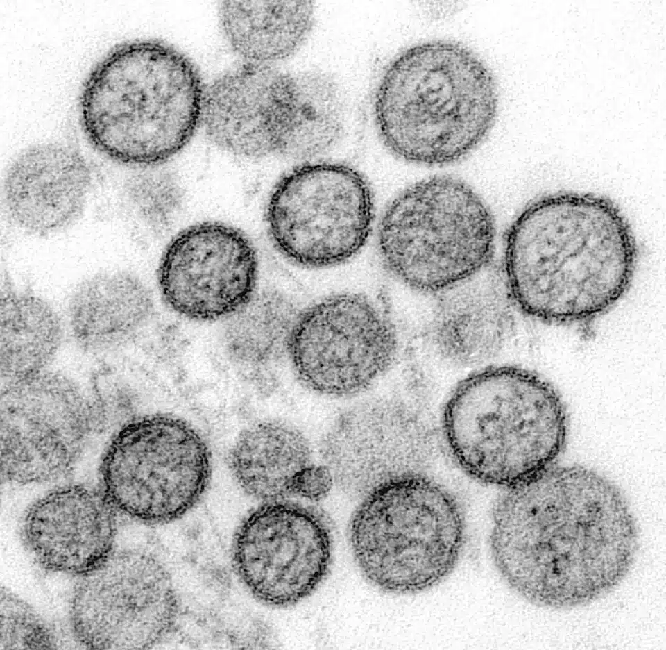 Elektronenmicroscopische opname van Sin Nombre-virusdeeltjes, een hantavirus dat bij mensen ernstige longklachten kan veroorzaken.